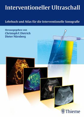 Dietrich / Nürnberg |  Interventioneller Ultraschall | eBook | Sack Fachmedien