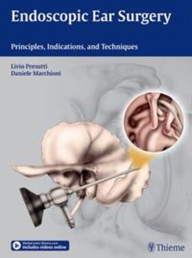 Presutti / Marchioni |  Endoscopic Ear Surgery | Buch |  Sack Fachmedien