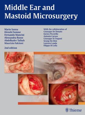 Sanna / Sunose / Russo |  Middle Ear and Mastoid Microsurgery | eBook | Sack Fachmedien