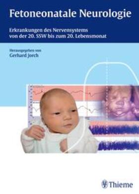 Jorch |  Jorch, G: Fetoneonatale Neurologie | Buch |  Sack Fachmedien