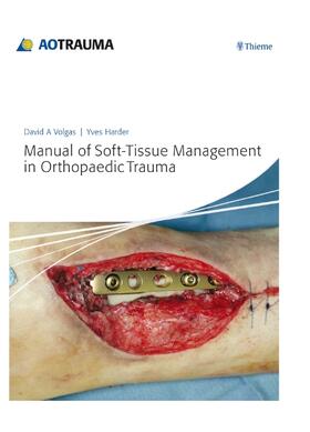 Harder / Volgas |  Manual of Soft-Tissue Management in Orthopaedic Trauma | eBook | Sack Fachmedien