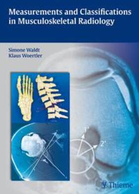 Waldt / Wörtler |  Measurements and Classifications in Musculoskeletal Radiology | Buch |  Sack Fachmedien
