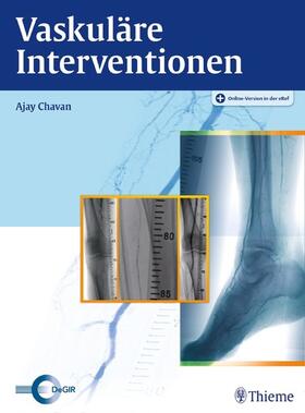 Chavan |  Vaskuläre Interventionen | eBook | Sack Fachmedien