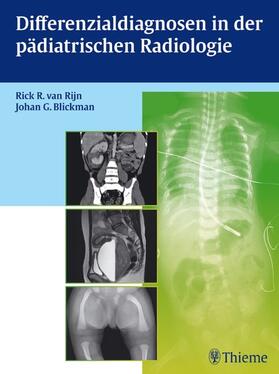  Differenzialdiagnosen in der pädiatrischen Radiologie | eBook | Sack Fachmedien
