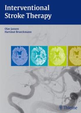 Jansen / Brückmann |  Interventional Stroke Therapy | Buch |  Sack Fachmedien