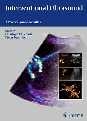 Dietrich / Nürnberg |  Interventional Ultrasound | Buch |  Sack Fachmedien