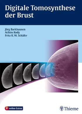 Barkhausen / Rody / Schäfer |  Digitale Tomosynthese der Brust | Buch |  Sack Fachmedien