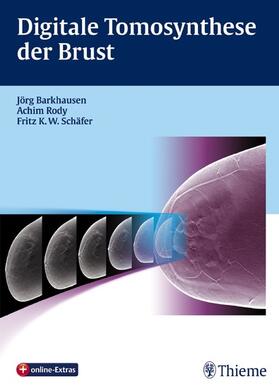 Barkhausen / Rody / Schäfer |  Digitale Tomosynthese der Brust | eBook | Sack Fachmedien