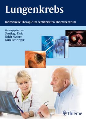Ewig / Hecker / Behringer |  Lungenkrebs | eBook | Sack Fachmedien
