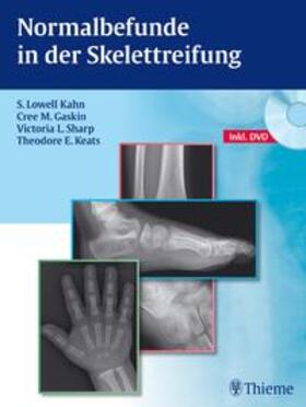 Kahn / Gaskin / Sharp |  Normalbefunde in der Skelettreifung | Buch |  Sack Fachmedien