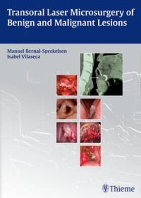 Bernal-Sprekelsen / Vilaseca |  Transoral Laser Microsurgery of Benign and Malignant Lesions | Buch |  Sack Fachmedien