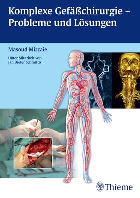 Mirzaie |  Komplexe Gefäßchirurgie - Probleme und Lösungen | eBook | Sack Fachmedien