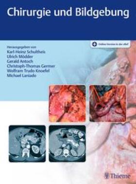 Schultheis / Mödder / Antoch |  Chirurgie und Bildgebung | Buch |  Sack Fachmedien