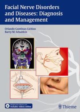 Guntinas-Lichius / Schaitkin |  Facial Nerve Disorders and Diseases: Diagnosis and Management | Buch |  Sack Fachmedien