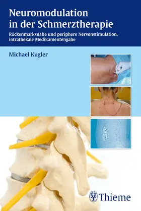 Kugler |  Neuromodulation in der Schmerztherapie | eBook | Sack Fachmedien