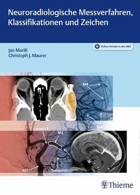 Mariß / Maurer |  Neuroradiologische Messverfahren, Klassifikationen und Zeichen | eBook | Sack Fachmedien