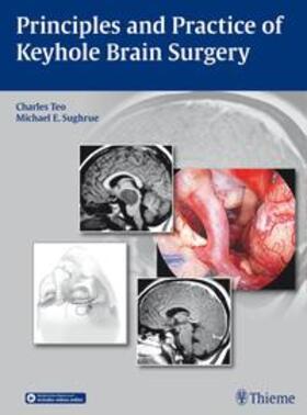 Teo / Sughrue |  Principles and Practice of Keyhole Brain Surgery | eBook | Sack Fachmedien