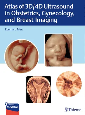 Merz |  Atlas of 3D/4D Ultrasound in Obstetrics, Gynecology, and Breast Imaging | Buch |  Sack Fachmedien