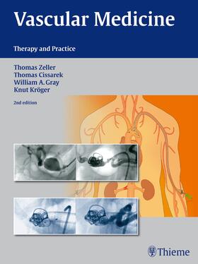 Zeller / Cissarek / Gray | Vascular Medicine | Buch | 978-3-13-176841-4 | sack.de