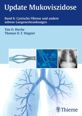 Hirche / Wagner |  Update Mukoviszidose, Band 6 | eBook | Sack Fachmedien