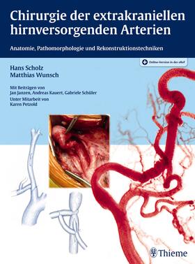 Scholz / Wunsch |  Chirurgie der extrakraniellen hirnversorgenden Arterien | Buch |  Sack Fachmedien