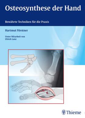 Förstner |  Osteosynthese der Hand | eBook | Sack Fachmedien