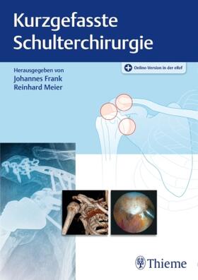 Frank / Meier |  Kurzgefasste Schulterchirurgie | Buch |  Sack Fachmedien