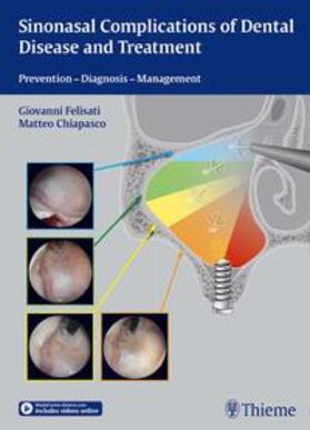 Felisati / Chiapasco |  Sinonasal Complications of Dental Disease and Treatment | Buch |  Sack Fachmedien