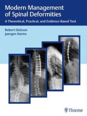 Dickson / Harms |  Modern Management of Spinal Deformities | eBook | Sack Fachmedien