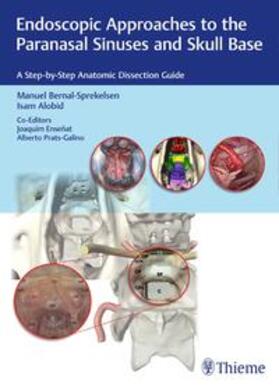 Bernal-Sprekelsen / Alobid / Ensenat |  Endoscopic Approaches to the Paranasal Sinuses a. Skull Base | Buch |  Sack Fachmedien