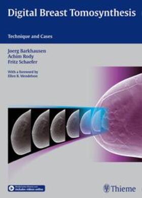 Barkhausen / Rody / Schäfer |  Digital Breast Tomosynthesis | Buch |  Sack Fachmedien
