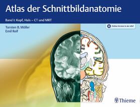 Möller / Reif |  Atlas der Schnittbildanatomie | eBook | Sack Fachmedien