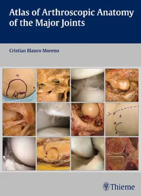 Blanco Moreno |  Atlas of Arthroscopic Anatomy of the Major Joints | Buch |  Sack Fachmedien