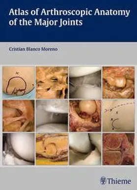 Blanco Moreno |  Atlas of Arthroscopic Anatomy of the Major Joints | eBook | Sack Fachmedien