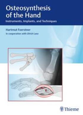 Förstner |  Osteosynthesis of the Hand | Buch |  Sack Fachmedien