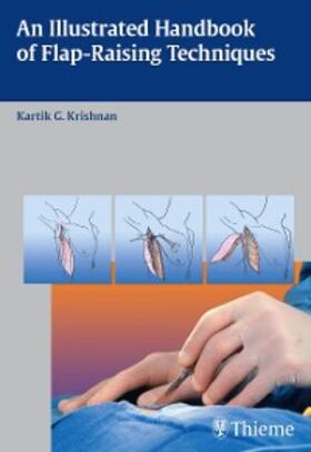 Krishnan |  An Illustrated Handbook of Flap-Raising Techniques | eBook | Sack Fachmedien