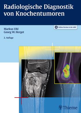 Uhl / Herget |  Radiologische Diagnostik von Knochentumoren | eBook | Sack Fachmedien