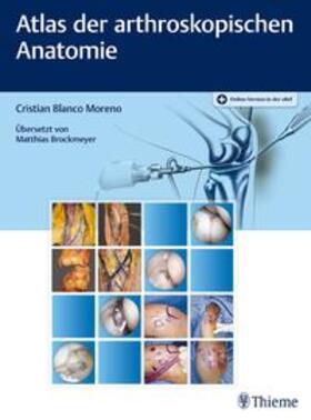 Blanco Moreno |  Atlas der arthroskopischen Anatomie | Buch |  Sack Fachmedien