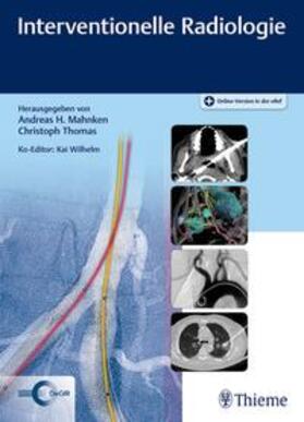 Mahnken / Thomas / Wilhelm |  Interventionelle Radiologie | Buch |  Sack Fachmedien
