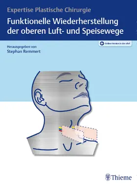 Remmert |  Funktionelle Wiederherstellung der oberen Luft- und Speisewege | Buch |  Sack Fachmedien