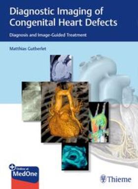 Gutberlet | Diagnostic Imaging of Congenital Heart Defects | Medienkombination | 978-3-13-240251-5 | sack.de