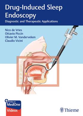 de Vries / Piccin / Vicini |  Drug-Induced Sleep Endoscopy | Buch |  Sack Fachmedien