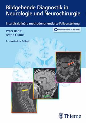 Berlit / Grams |  Bildgebende Diagnostik in Neurologie und Neurochirurgie | eBook | Sack Fachmedien