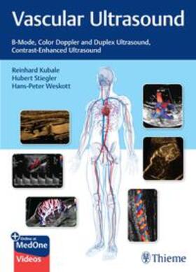 Kubale / Stiegler / Weskott |  Vascular Ultrasound | eBook | Sack Fachmedien