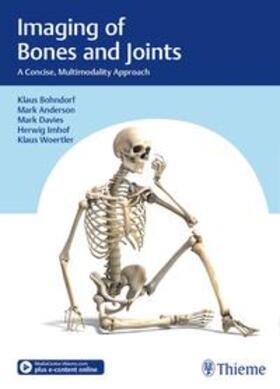 Bohndorf / Anderson / Davies |  Imaging of Bones and Joints | eBook | Sack Fachmedien
