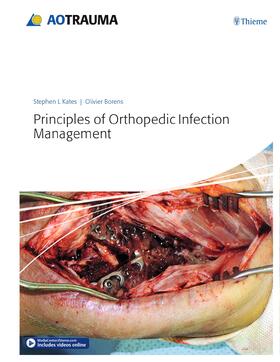 Kates / Borens |  Principles of Orthopedic Infection Management | Buch |  Sack Fachmedien