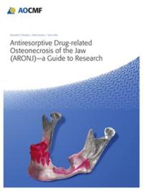 Fleisher / Kontio / Otto |  Antiresorptive Drug-Related Osteonecrosis of the Jaw (ARONJ) - A Guide to Research | Buch |  Sack Fachmedien
