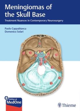Cappabianca / Solari |  Meningiomas of the Skull Base | Buch |  Sack Fachmedien