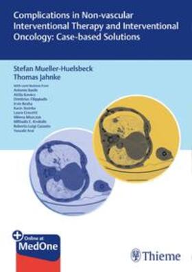 Müller-Hülsbeck / Jahnke |  Complications in Non-vascular Interventional Therapy | Buch |  Sack Fachmedien