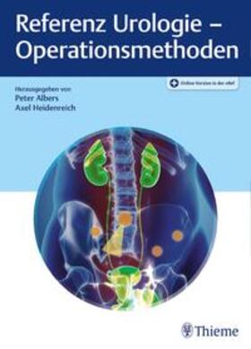 Albers / Heidenreich / Addali |  Referenz Urologie - Operationsmethoden | Buch |  Sack Fachmedien